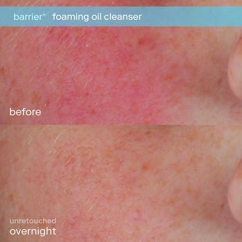 Skinfix barrier+ Foaming Oil Cleanser 177ml - Zine Beauty Shop - Zine Beauty Shop