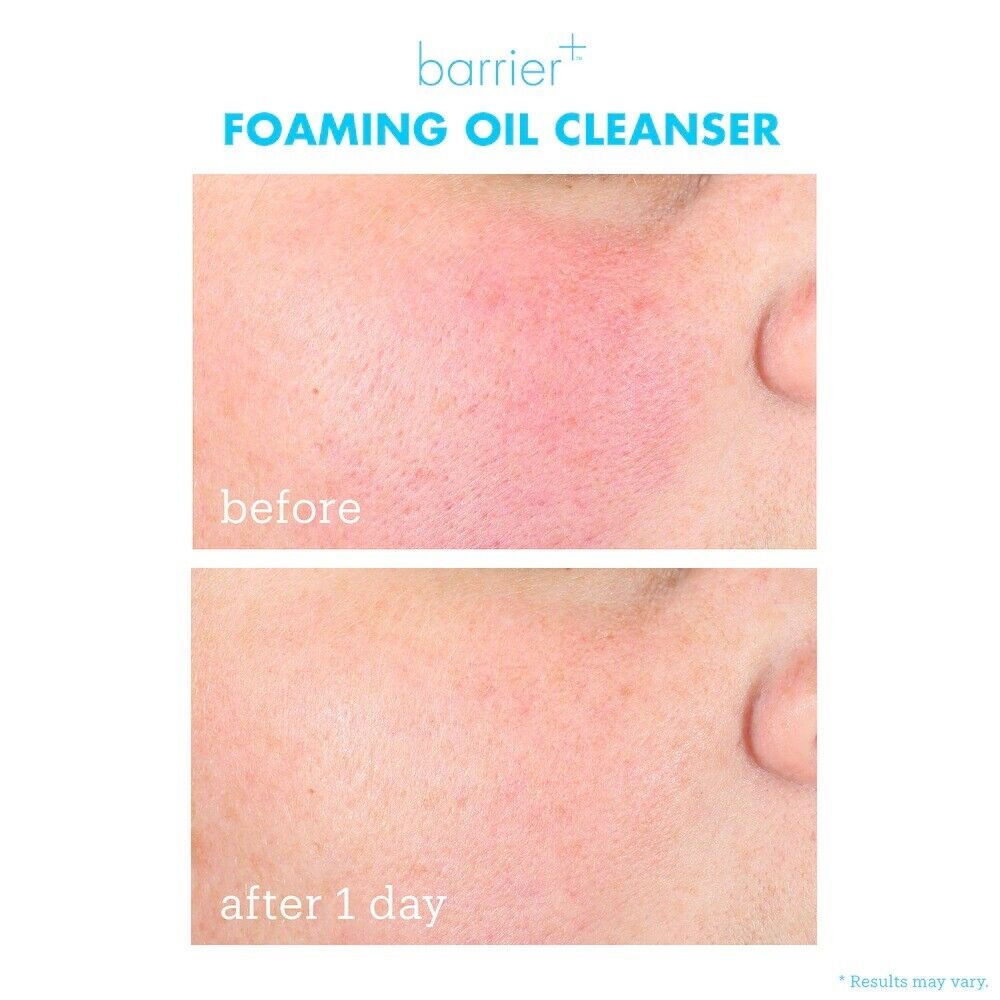 Skinfix barrier+ Foaming Oil Cleanser 177ml - Zin Beauty Shop - Zine Beauty Shop