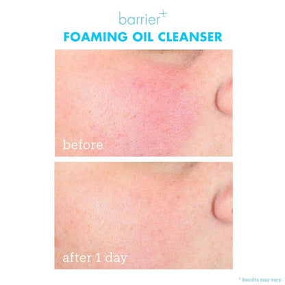 Skinfix barrier+ Foaming Oil Cleanser 177ml - Zine Beauty Shop - Zine Beauty Shop